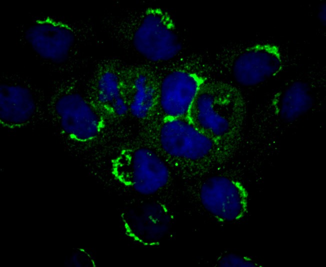Anti-PLEKHH1 Antibody (8U514)