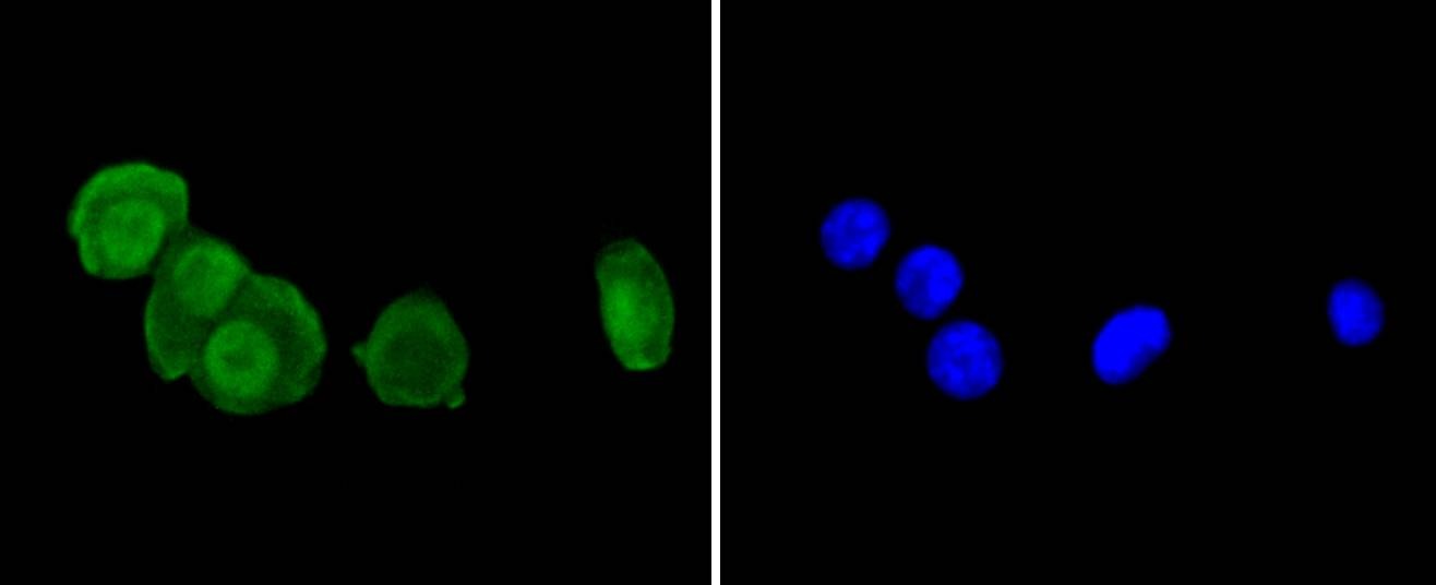 Anti-PRNP/Prion Antibody (2B223)