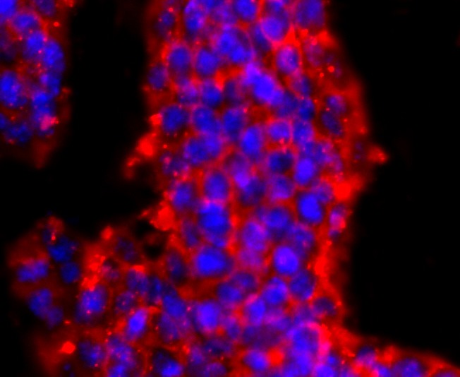 Anti-PRMT1 Antibody (6O126)