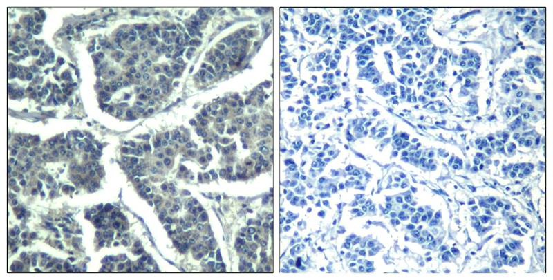 Anti-Phospho-PLCg2 (Tyr1217) Polyclonal Antibody
