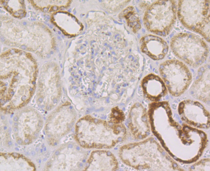 Anti-PIST Antibody (5T628)