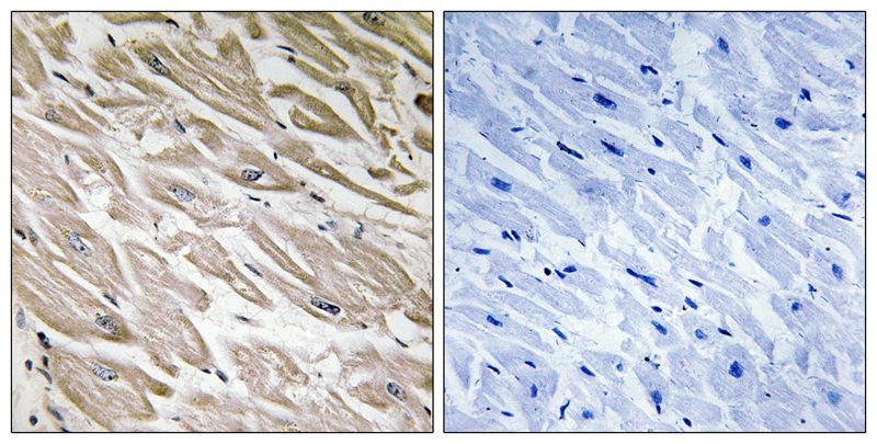Anti-Phospho-PPP1R2 (Ser120, 121) Polyclonal Antibody