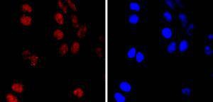 Anti-PMS2 Antibody (2B500)