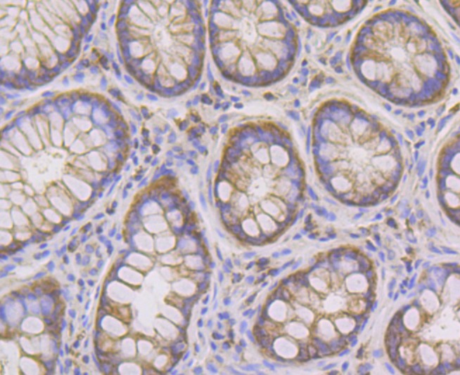 Anti-PIST Antibody (5T628)