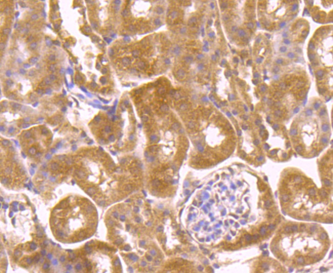 Anti-PLEKHH1 Antibody (8U514)