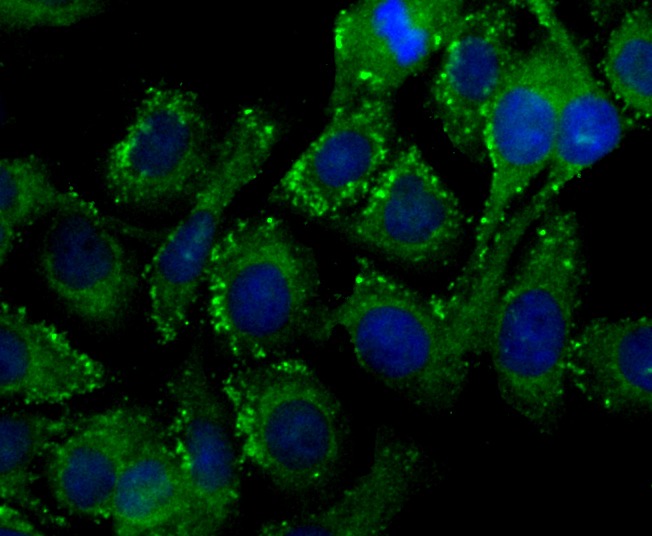 Anti-PIST Antibody (5T628)