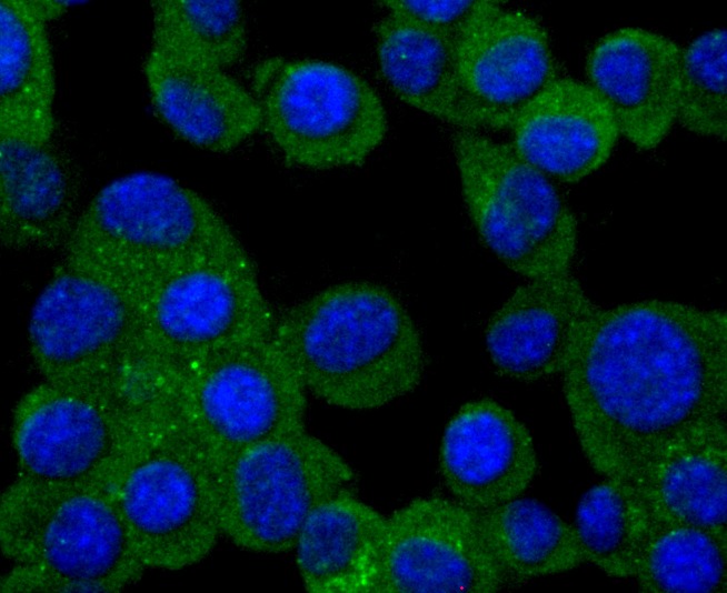 Anti-PMP22 Antibody (3X860)