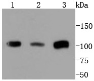 Anti-PMS2 Antibody (2B500)