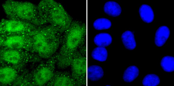Anti-PRMT1 Antibody (6O126)