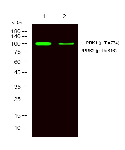 Anti-Phospho-PKN1 (Thr774, 816) Polyclonal Antibody