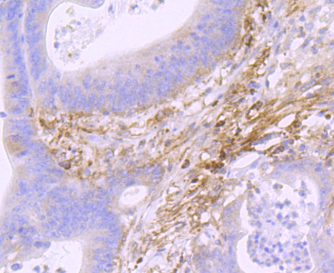 Anti-Podoplanin Antibody (9X102)
