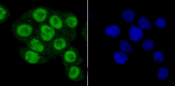 Anti-PRMT1 Antibody (6O126)