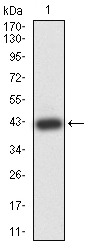 Anti-PRKAG3 Antibody (6D439)