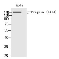 Anti-Phospho-Pragmin (Tyr413) Polyclonal Antibody