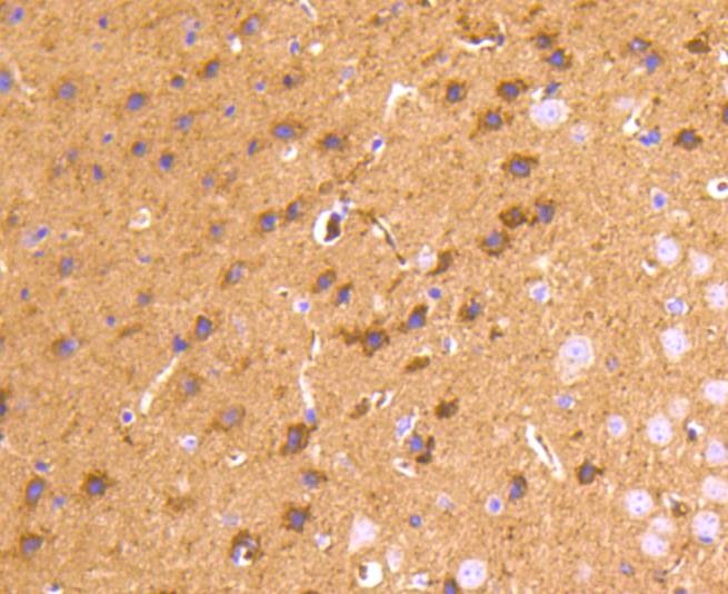 Anti-PRNP/Prion Antibody (2B223)