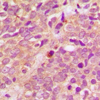 Anti-Phospho-PRKD1/2/3 (Ser738/742) Polyclonal Antibody