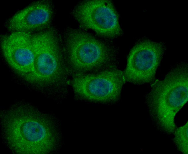 Anti-PIST Antibody (5T628)