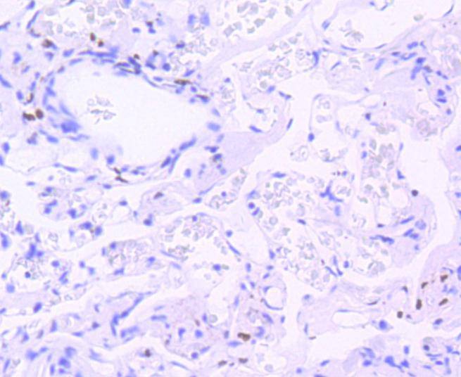 Anti-Phospho-STAT3 (Tyr705) Antibody (5W52)