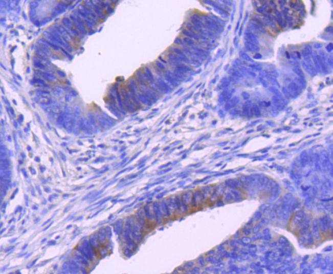 Anti-Phospho-MAP2K1 (Ser298) Antibody (9P567)