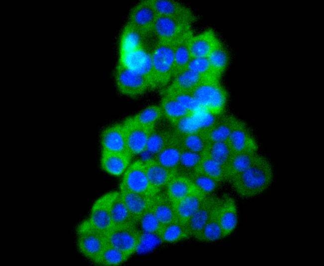 Anti-Phospho-BRAF (Thr401) Antibody (6W728)