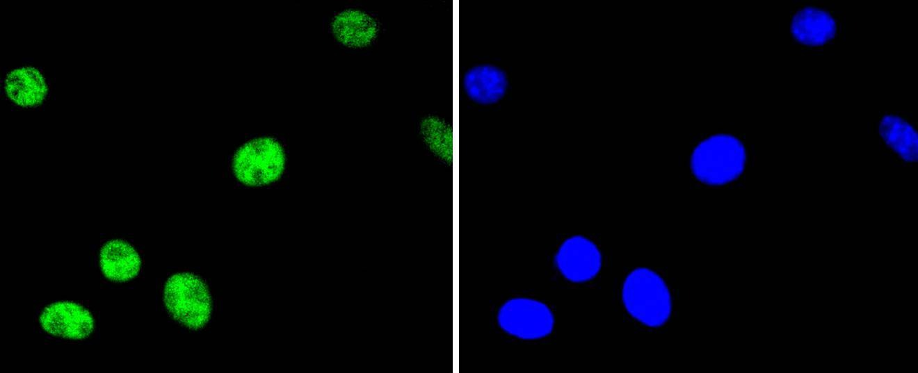Anti-Phospho-ATF2 (Thr71) Antibody (3X852)