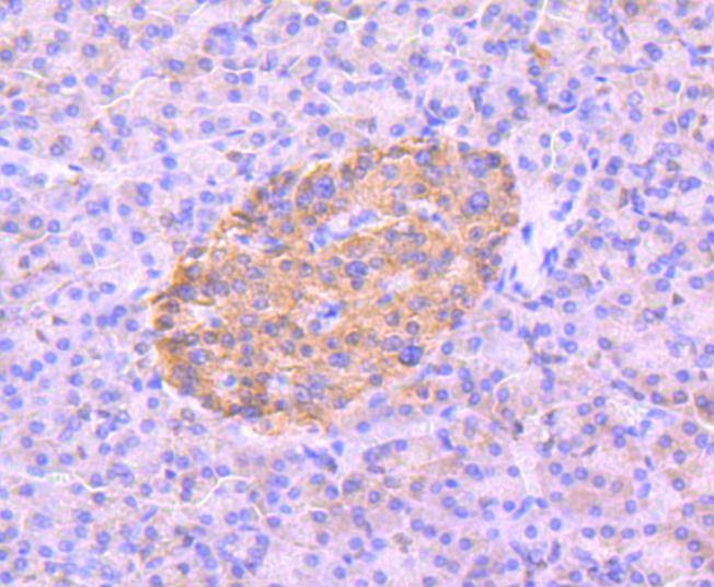 Anti-Phospho-PRKAA2 (Ser345) Antibody (4R913)