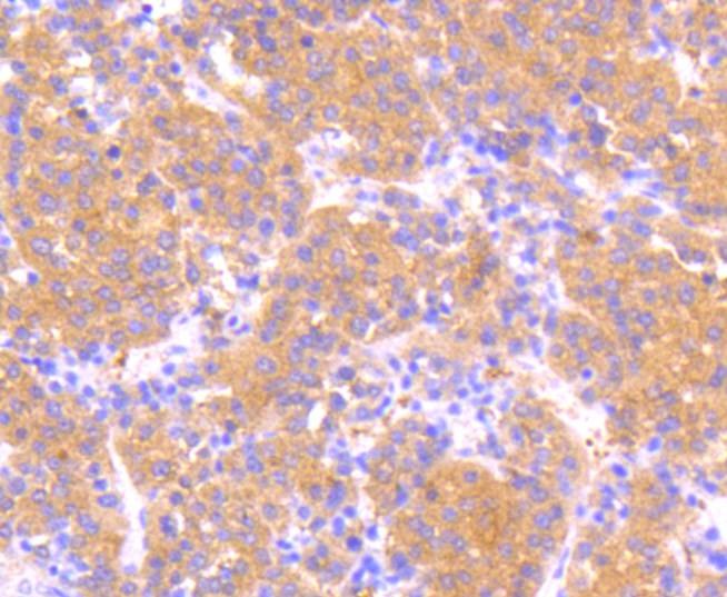 Anti-Phospho-MAP2K1 (Ser218, 222) Antibody (3S158)