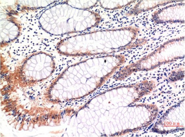 Anti-Phospho-MLKL (Ser358) Antibody (8A793)