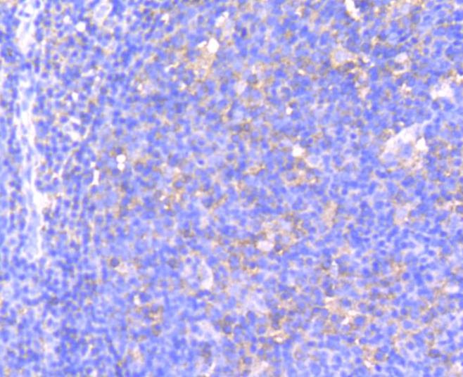 Anti-Phospho-MAP2K1 (Ser218, 222) Antibody (3S158)