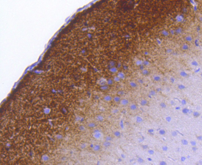Anti-Phospho-Synapsin-1 (Ser9) Antibody (8A406)