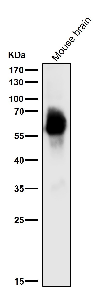 Anti-Phospho-MAPT (Ser396) Antibody (4F595)