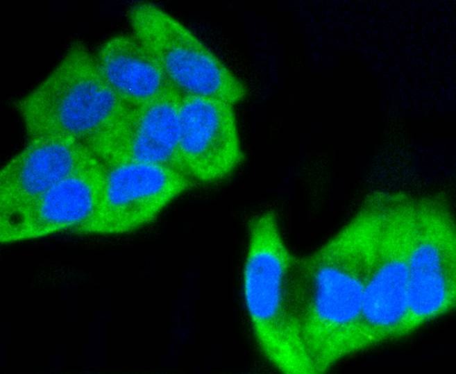 Anti-Phospho-MAP2K1 (Ser218, 222) Antibody (3S158)