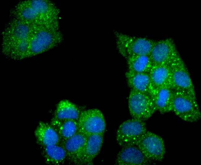 Anti-Phospho-PRKAA2 (Ser345) Antibody (4R913)