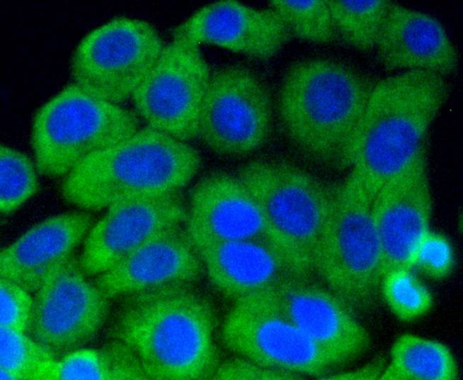 Anti-Phospho-MAP2K1 (Ser218, 222) Antibody (3S158)