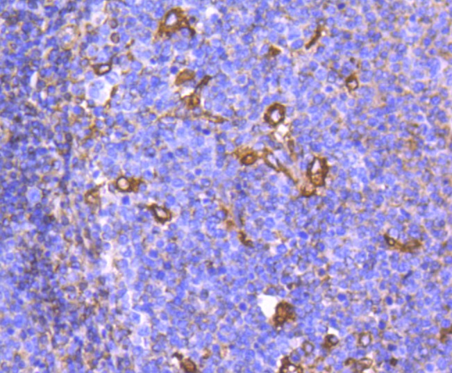 Anti-Phospho-CHEK1 (Ser296) Antibody (1L434)