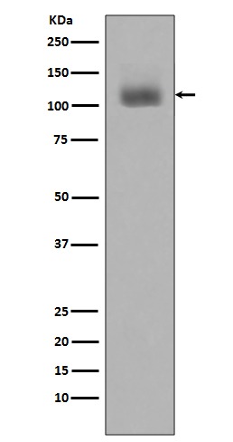 Anti-Phospho-JAK2 (Tyr1007, 1008) Antibody (1D853)