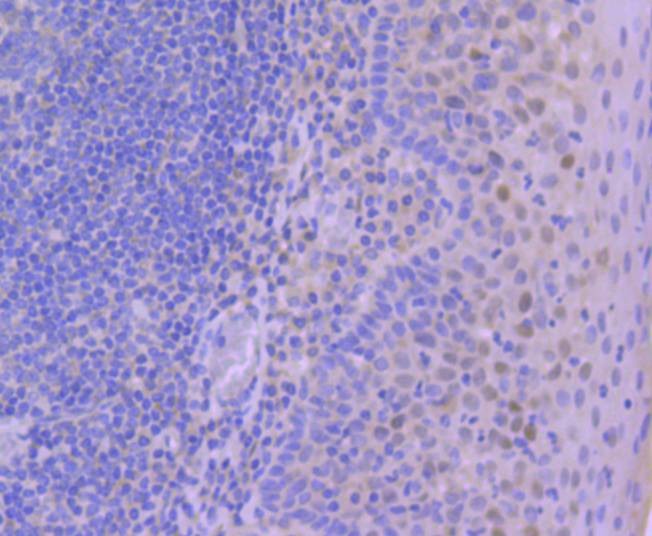 Anti-Phospho-JUN (Ser63) Antibody (4N22)