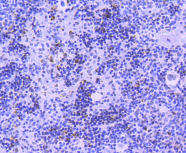 Anti-Phospho-JAK2 (Tyr1007, 1008) Antibody (1D853)