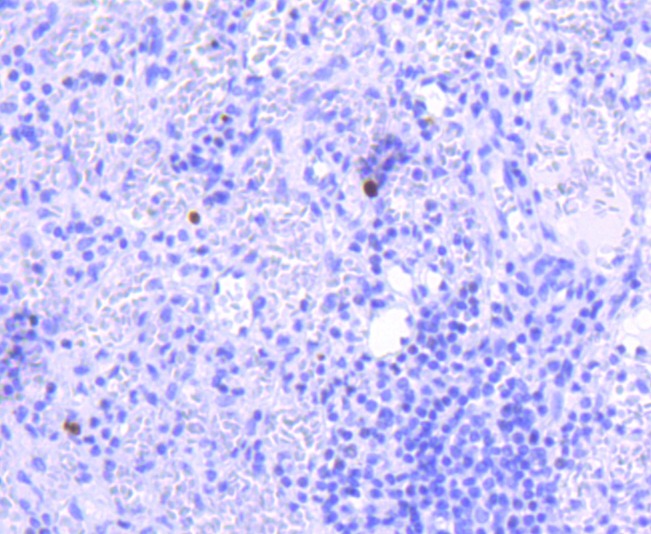 Anti-Phospho-JAK2 (Tyr1007, 1008) Antibody (1D853)