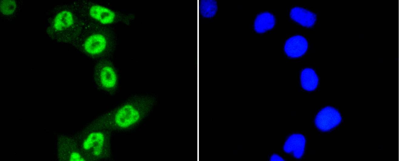 Anti-Phospho-STAT3 (Ser727) Antibody (9W152)
