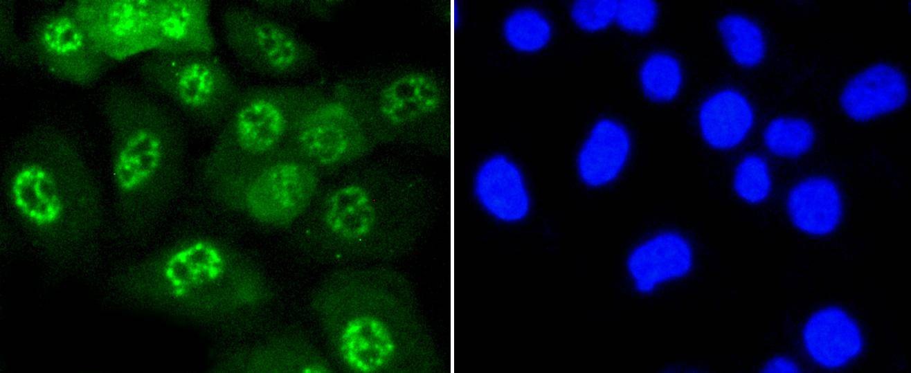 Anti-Phospho-JNK1/2/MAPK10 (Thr183/183/221) Antibody (7N200)