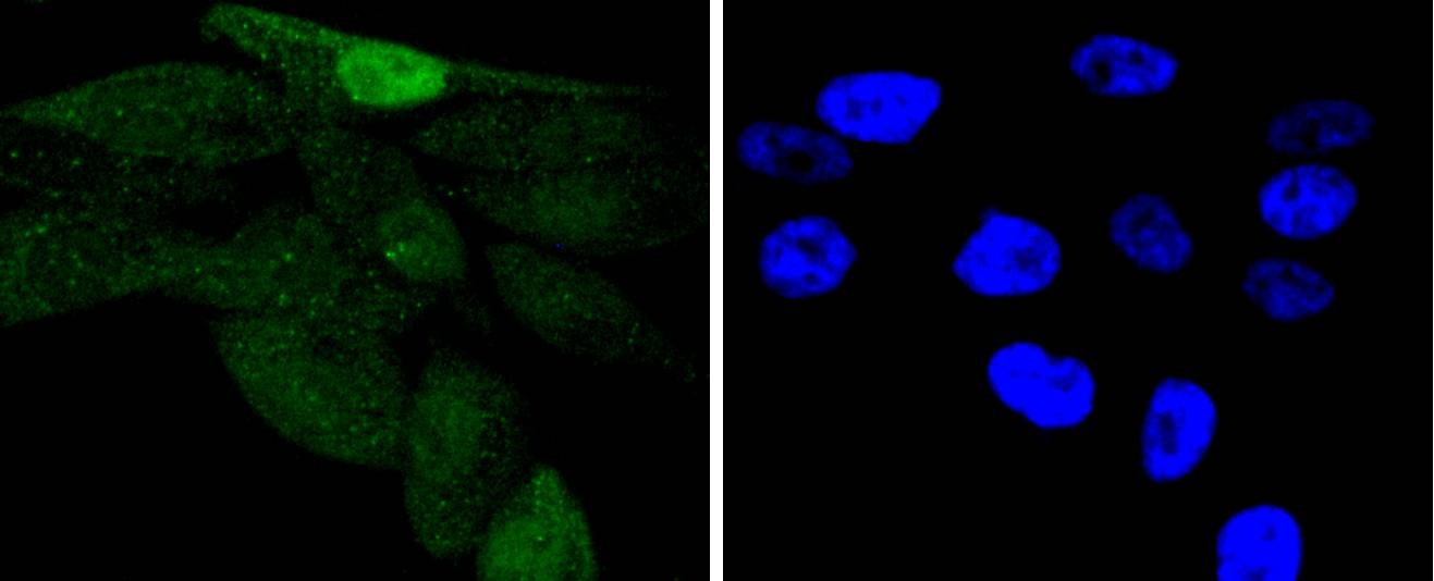 Anti-Phospho-JUN (Ser63) Antibody (4N22)