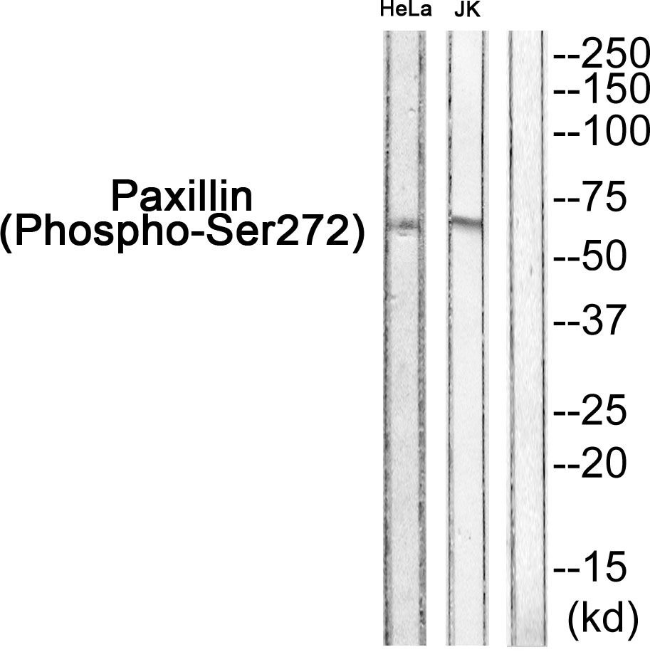 Anti-Phospho-PXN (Ser272) Polyclonal Antibody
