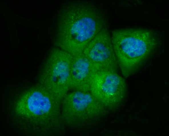 Anti-PAK2 Antibody (7G572)