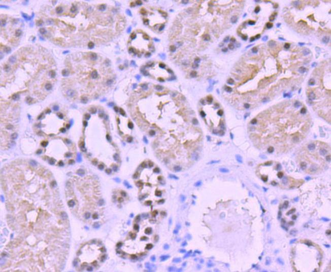 Anti-PAX8 Antibody (4E844)