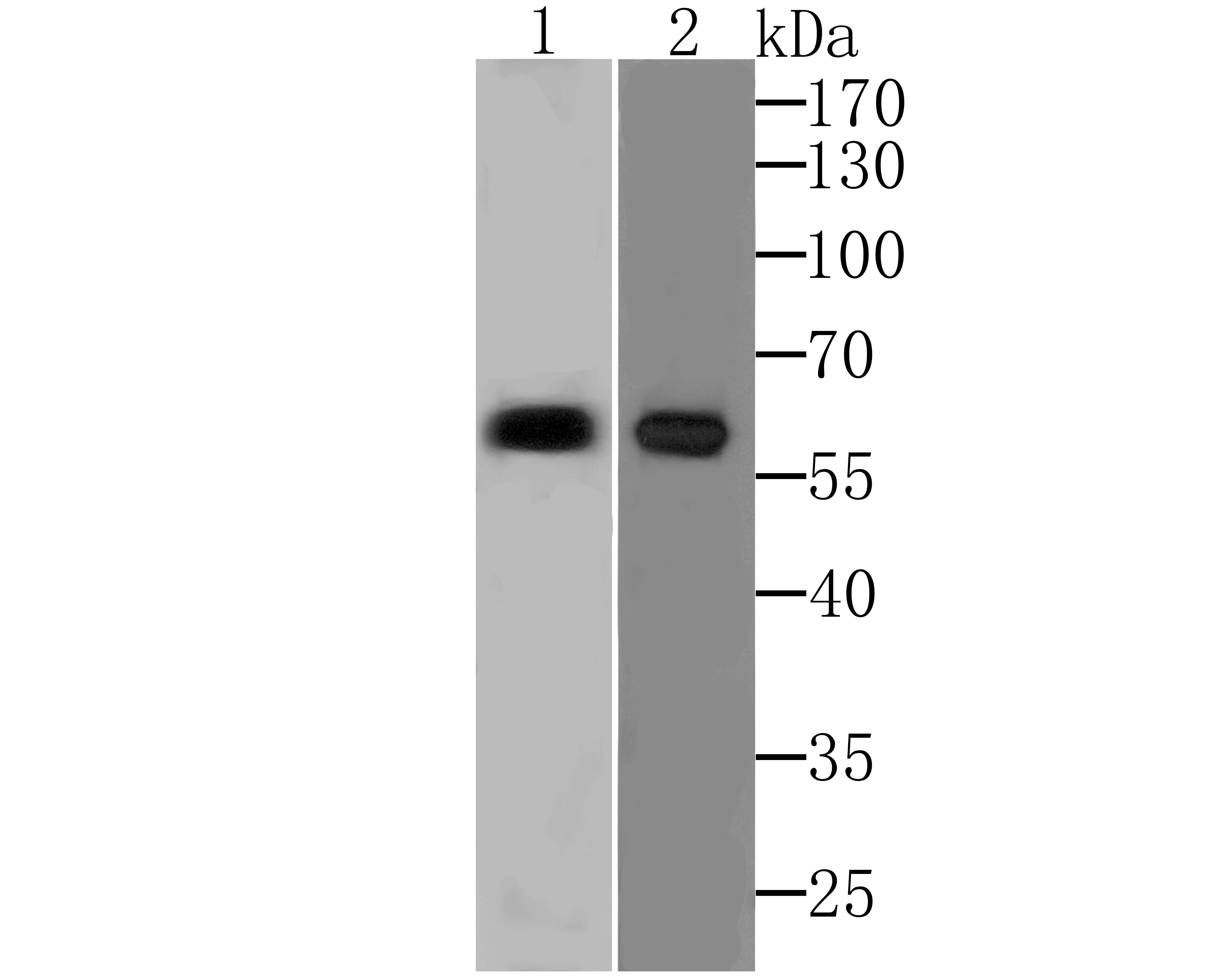 Anti-PARP2 Antibody (2T560)