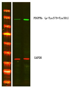 Anti-Phospho-PDGFRB (Tyr579, 581) Polyclonal Antibody