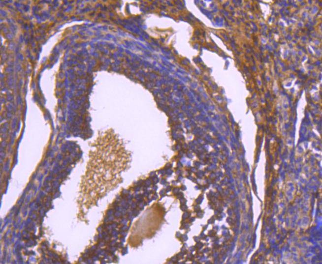 Anti-PXN Antibody (8Y831)