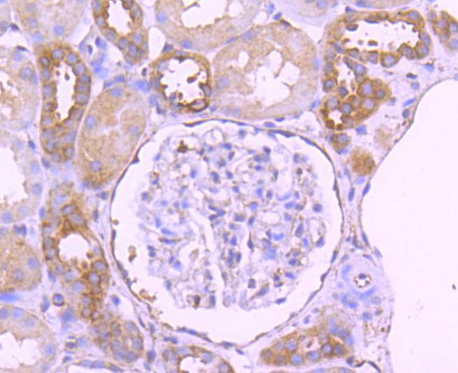 Anti-PXN Antibody (8Y831)