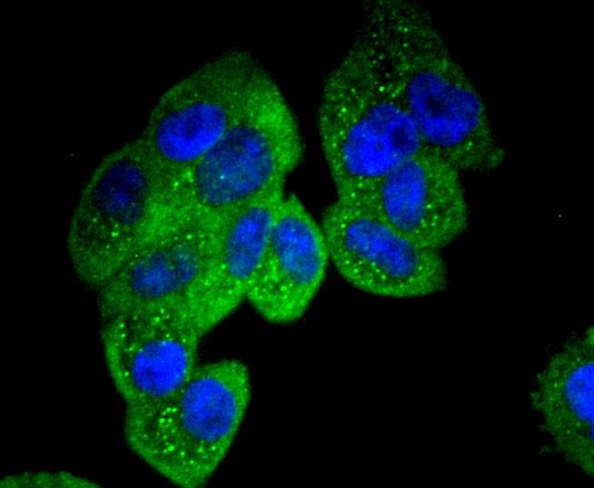 Anti-PXN Antibody (8Y831)
